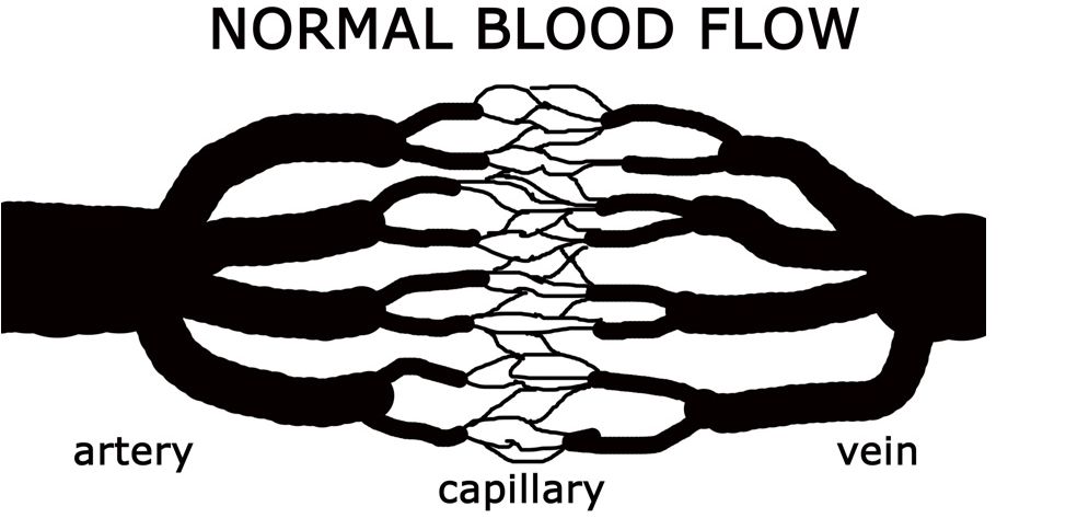 NORMAL BLOOD FLOW: LƯU LƯỢNG MÁU BÌNH THƯỜNG