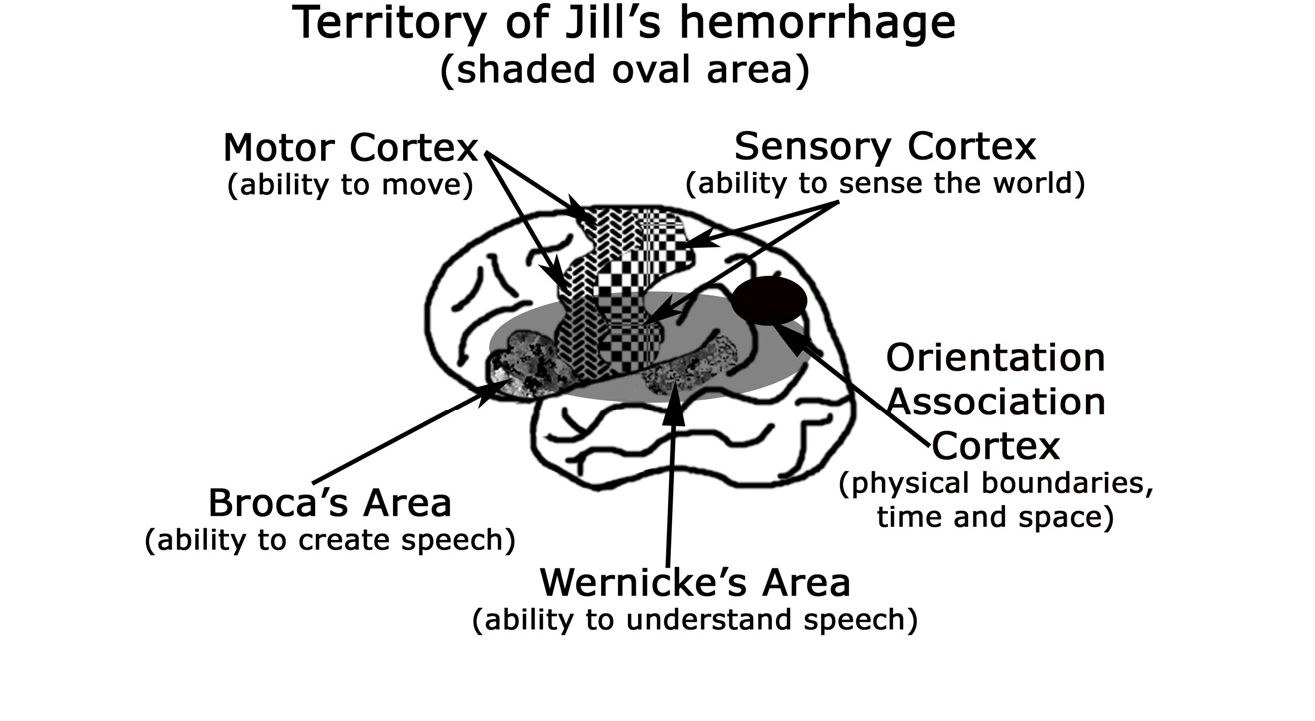 Territory of Jill's hemorrhage: Vùng xuất huyết của Jill